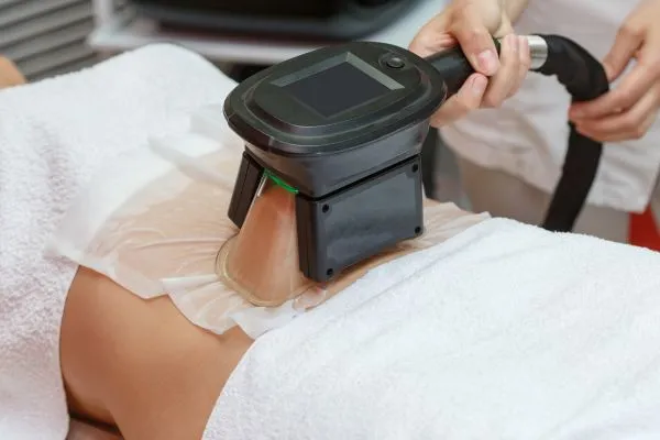 Image of person having fat freezing treatment to help weight gain Islington