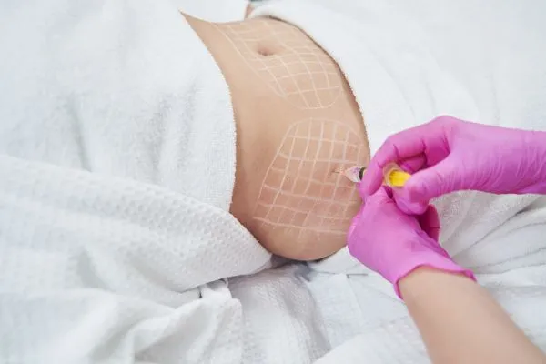 image of fat dissolving injections on love handles to help combat weight gain Islington