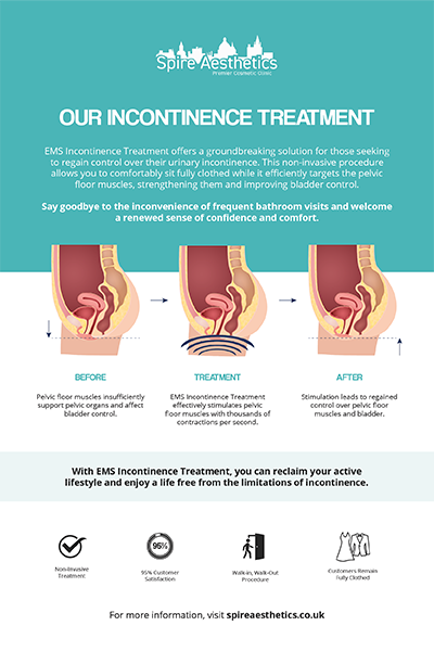 image to show how EMS treatment works for female urinary incontinence Islington