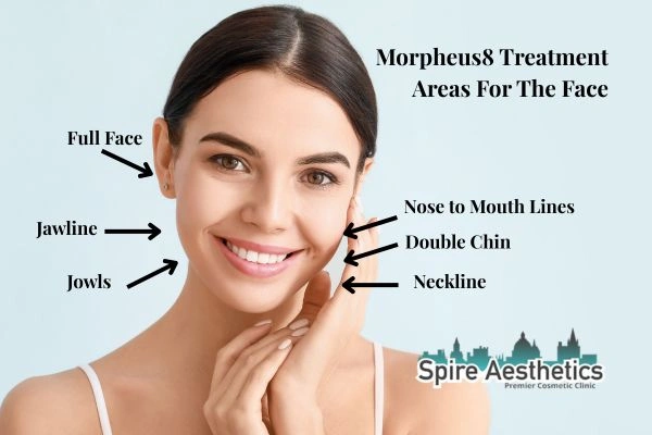 Where can Morpheus8 Treatment Islington be done on the body?