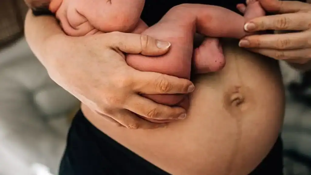 Why Is My Stomach Still Big After Pregnancy Islington?